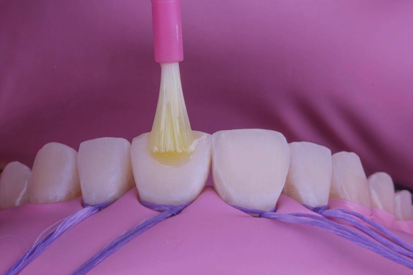 Caso Clínico 6 - Finalização