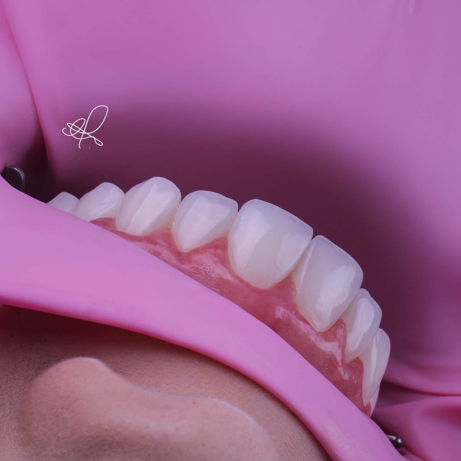 Caso Clínico 8 - Antes e Depois