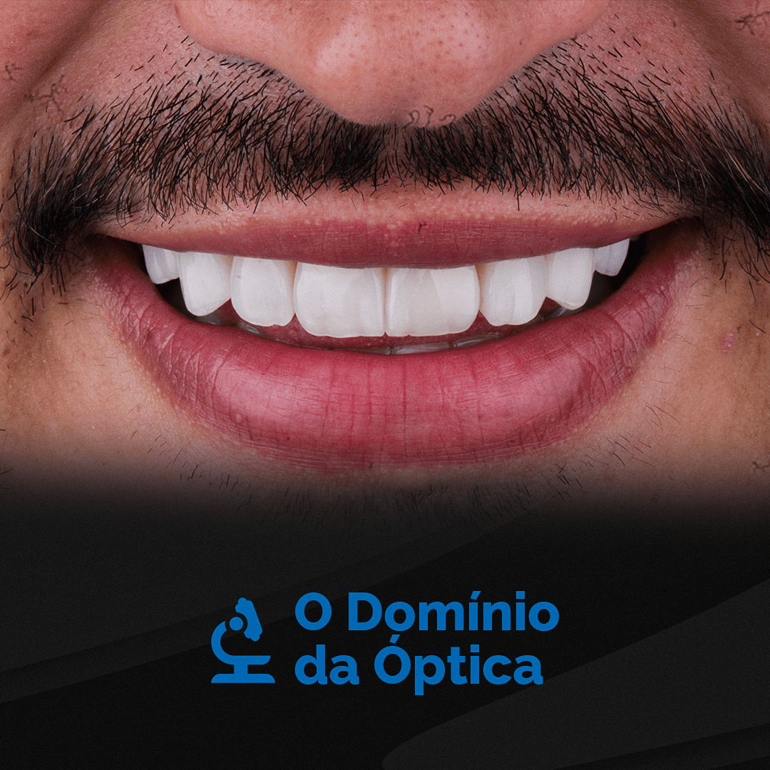 Textura e Acabamento Natural