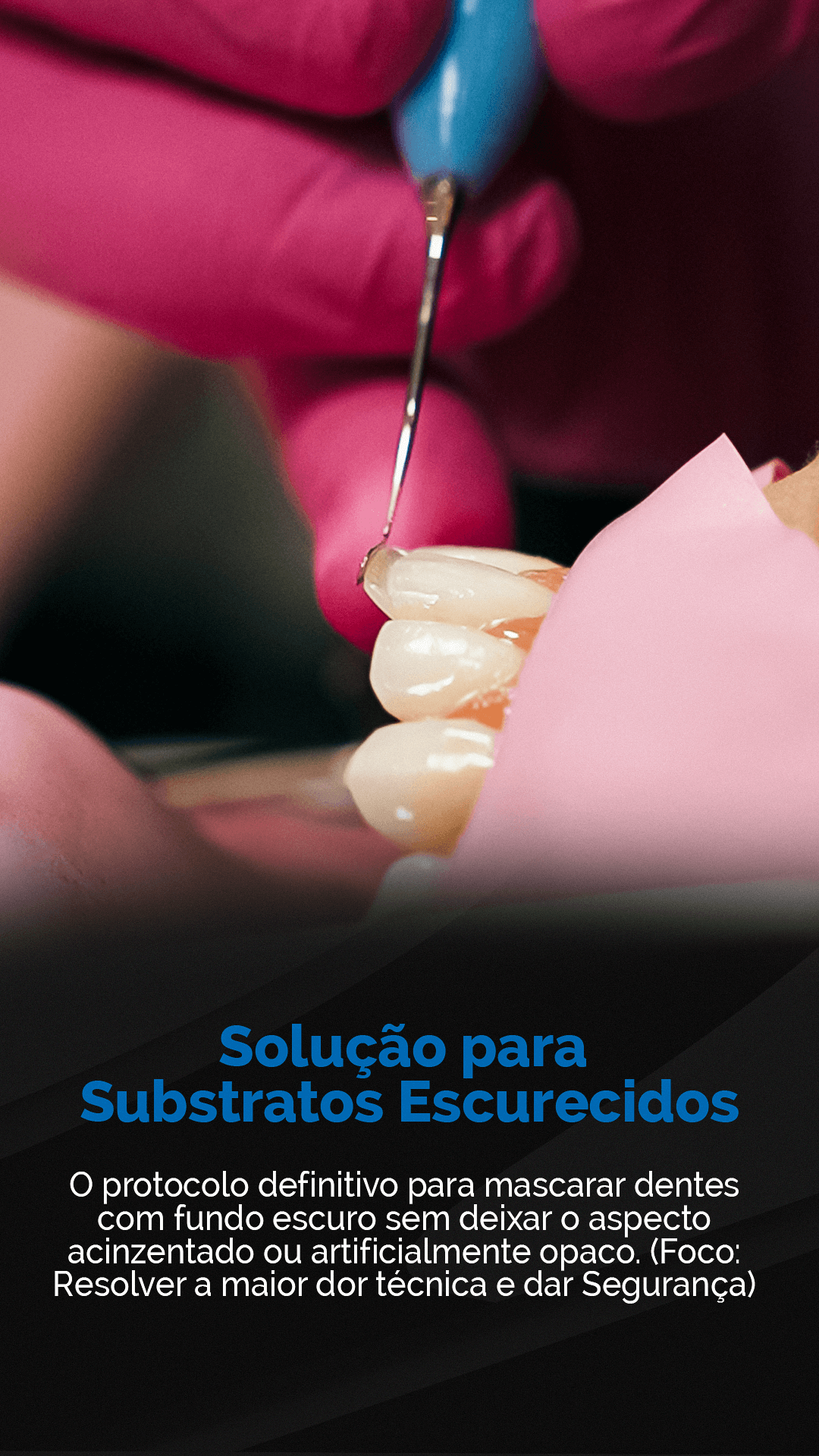 Planejamento Reverso